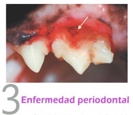 enfermedad periodontal neko