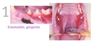gingivoestomatitis